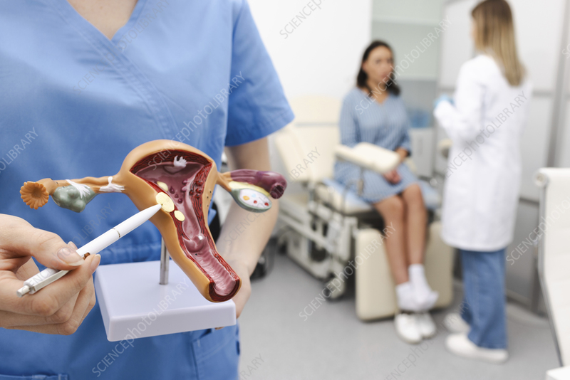 Uterine Fibroids